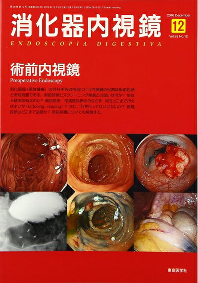 【中古】 消化器内視鏡第28巻12号 術前内視鏡
