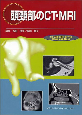 楽天市場】頭頚部 ct mriの通販