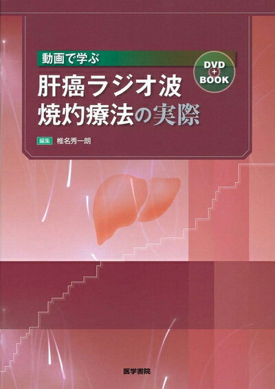 【中古】（新古品・未使用品） 動画で学ぶ肝癌ラジオ波焼灼療法の実際: DVD+book