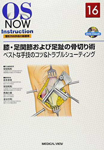 【中古】 膝・足関節および足趾の骨切り術−ベストな手技のコツ&トラブルシューティ...