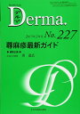 【中古】(新古品・未使用品) 蕁麻疹最新ガイド (MB Derma(デルマ))