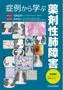 【中古】(新古品・未使用品) 症例から学ぶ薬剤性肺障害【電子版付】