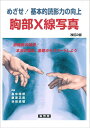 【中古】(新古品・未使用品) めざせ!基本的読影力の向上胸部X線写真 改訂版