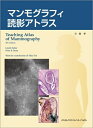 【中古】(新古品・未使用品) マンモグラフィ読影アトラス