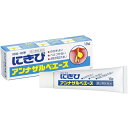 【第2類医薬品】アンナザルベ・エース 【18g】(エスエス製薬)【湿疹・かゆみ/にきび】