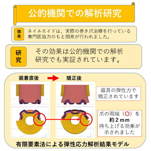 巻き爪治し方自分で巻き爪治療【ネイルエイド】まきづめ矯正リフト爪ブロックガードケア14mm