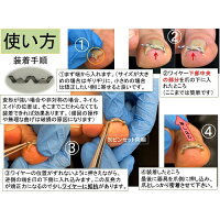 楽天市場 巻き爪 治療 自分で 矯正 ネイル エイド クリップ ワイヤー ガード 爪ブロック リフト テープ ロボ 巻きづめ 巻爪 介護 18mm 巻き爪 陥入爪治療の相談室 楽天市場 巻き爪 治療 自分で 矯正 ネイル エイド クリップ ワイヤー ガード 爪ブロック リフト テープ ロボ 巻きづめ 巻爪 介護 18mm 巻き爪 陥入爪治療の相談室