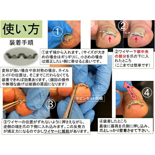 楽天市場 巻き爪 治療 自分で 矯正 ネイル エイド クリップ ワイヤー ガード 爪ブロック リフト テープ ロボ 巻きづめ 巻爪 介護 18mm 巻き爪 陥入爪治療の相談室