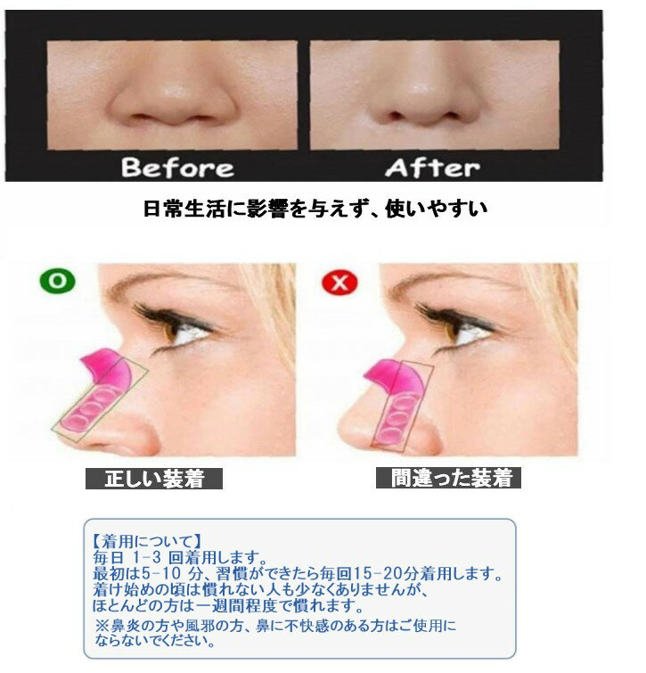 ノーズアップ シリコンノーズパッド 鼻用 鼻クリップ ノーズクリップ[定形外郵便、送料無料、代引不可]