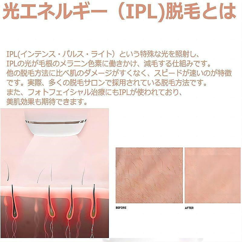 脱毛器 女性 脱毛機 光脱毛器 レディース メンズ 髭 vio対応 脱毛機 脱毛 光 家庭 ...