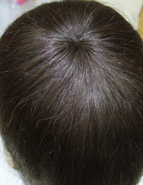 手編み、手植え ロング 人毛100%ウィッグ 発毛促進セットとwig capをプレゼント致します 【かつら】【かつら女性用】【人毛】【人毛ウィッグ】【医療用ウイッグ】【医療用かつら】【医療用対応ウイッグ】【ショートウイッグ】