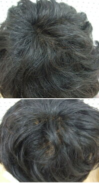 手植え、手編み 人毛100%ウィッグ 発毛促進セットとwig capをプレゼント。【かつら】【かつら 女性用】【人毛】【人毛 ウィッグ】【医療用ウイッグ】【医療用かつら】【医療用対応ウイッグ】【医療用対応かつら】【ショートかつら】