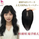 「交換返品OK」部分ウィッグ 人毛100% 総手植え リアル人工皮膚 自然 ヘアピース 人毛 医療用 ウィッグ 頭頂部 つむじ 人毛部分ウィッ..