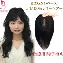 返品 交換 承ります! 部分 ウィッグ かつら 人毛100% 総手植え リアル 人工皮膚 自然 ヘアピース 人毛 医療用 頭頂部 つむじ 人毛 部分ウィッグ レ...