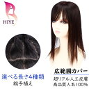 部分ウィッグ 広範囲ヘアピース 人毛 100% 20cm～ 25cm～ 30cm～35cm～ ※前髪付き※ ウィッグ 自然 通気性 総手植え かつら カツラ ヘアピース 分け目 医療用ウィッグ 薄毛 脱毛 抜毛 薄毛症 脱毛症 抜毛症 抗がん剤治療 12-12〜