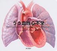 【送料無料】 うっ血性心不全 / 佐藤達夫 【単行本】