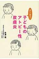 子どものアトピー性皮膚炎 正しく知ろう / 赤澤晃 【本】