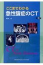 ここまでわかる急性腹症のCT / 荒木力 【本】