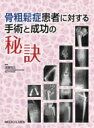 骨粗鬆症患者に対する手術と成功の秘訣 / 須藤啓広 【本】