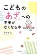 Medicine, Pharmacy - こどもの「あざ」への不安がなくなる本 / 矢加部文 【本】