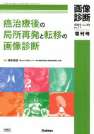 画像診断 2023年増刊号vol.43 No.11 癌治療後の局所再発と転移の画像診断 / 楠本昌彦 【全集・双書】