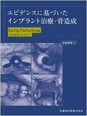 エビデンスに基づいたインプラント治療・骨造成 Early　Failure回避のためのコンセプト / 宗像源博 【本】