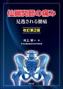 仙腸関節の痛み 見逃される腰痛 / 村上栄一 【本】