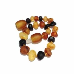 【送料無料】アクセサリー　ネックレスタイルバルトオレンジイギリスnios nias nio teja mixta genuino del bltico mbar tobillera crudo amor mbar x reino unido