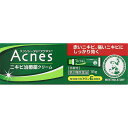 【送料無料】 【第2類医薬品】メンソレータムアクネスニキビ治療薬 18g