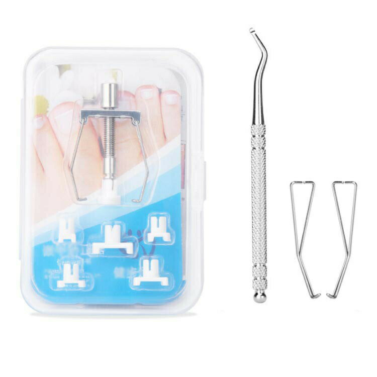 20分だけ改善 巻き爪 ネイルケア 巻爪ケア 2セット組 20分だけ改善 器具 巻爪 矯正 サポート ネイル ツ..