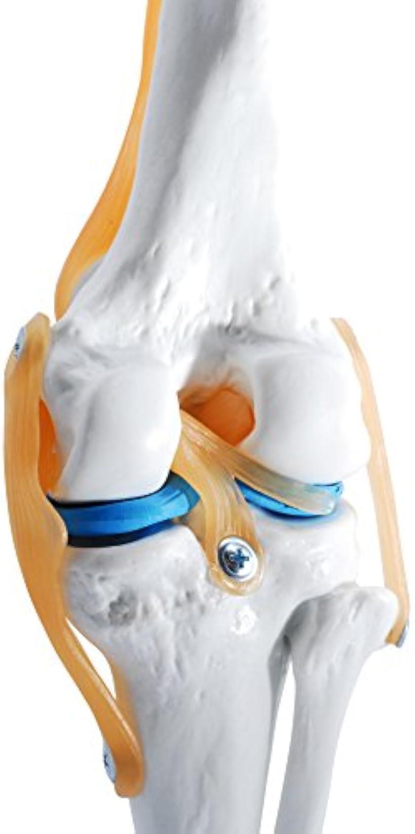 膝関 節模型 ひざ 靭帯 半月板 医療 学習用 モデル 台座 固定 (台座 固定)