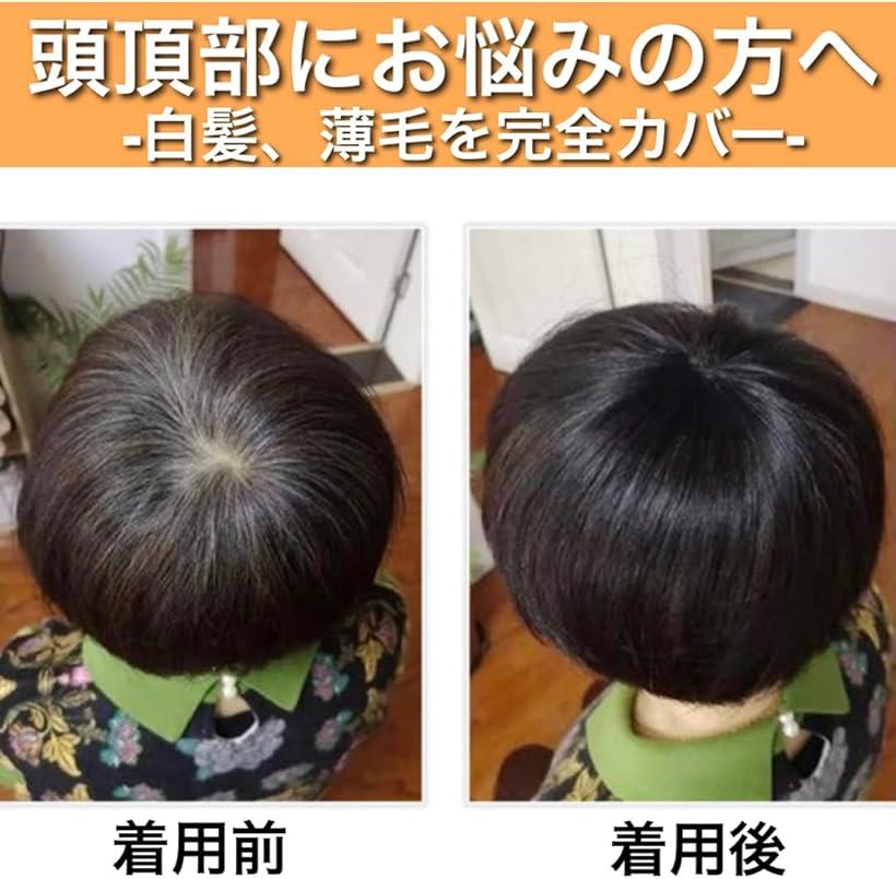 ヘアピース 人毛 部分ウィッグ かつら 男性 女性 カツラ トップウィッグ メンズ レディース つむじ 頭頂部 トップピース ポイントピース 人毛100% 部分カツラ ショート トップカバー(ナチュラルブラウン(ワイド))