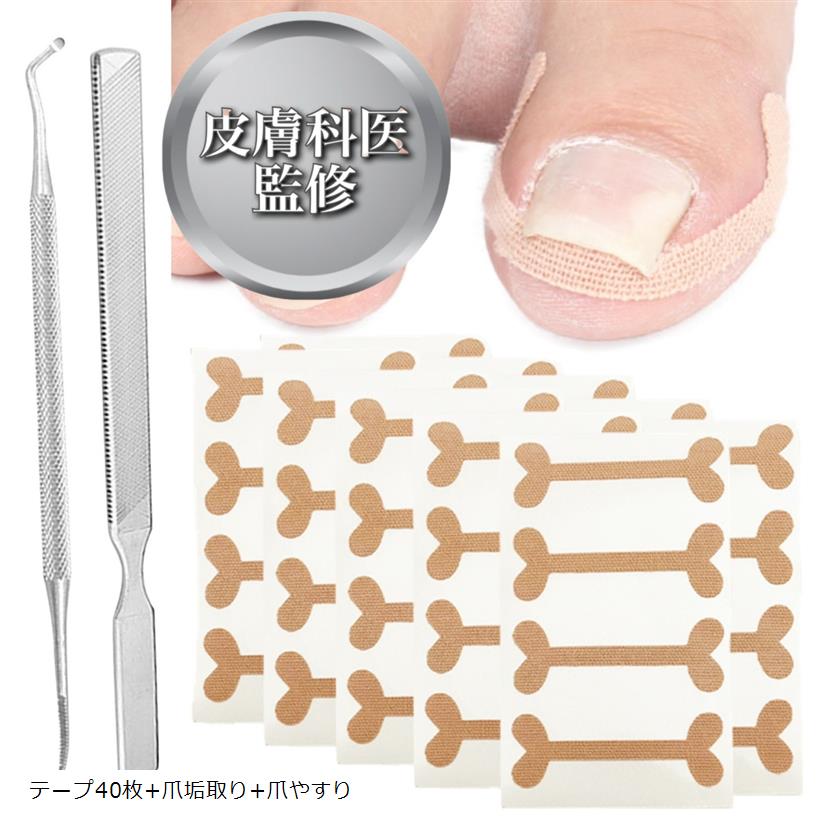 皮膚科医監修 巻き爪テープ 40枚 ケア 爪垢取り 巻爪 伸縮タイプ (テープ40枚+爪垢取り+爪やすり)