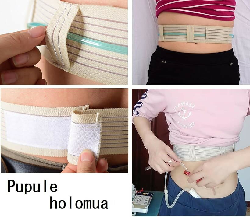 ププレホロムア 腹膜透析ベルト コンジット カテーテル チューブ ホルダー 保護 固...