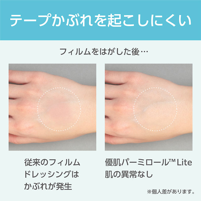 ホスピマートの優肌パーミロール Lite(ハンディロールタイプ) 5cm×12m L34R05 1巻 ニトムズ【極薄防水フィルム つっぱらない フィルムドレッシング 好きな長さにカットして使える 肌にやさしい かぶれにくい 入浴時の防水対策に】｜アングル3