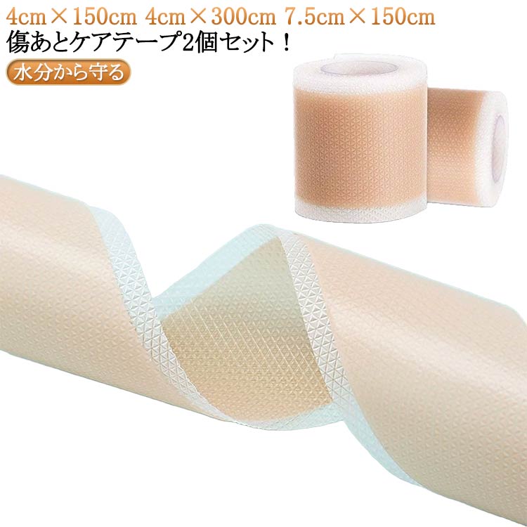 2個セット 傷テープ 帝王切開 傷あとケアテープ 帝王切開 手術後 傷あとケアテープ 傷あとケア用シリコンジェルシート ケロイド 傷跡ケアテープ シリコンテープ 貼り心地にもこだわった 保護テープ 傷隠し ケロイド 4cm×150cm 4cm×300cm