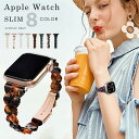 AppleWatchバンド アップルウォッチバンド アップルウォッチ アクリル バンド スリム Apple Watch ベルト べっ甲 軽量 工具付き おしゃれ シリーズ SE 9 8 7 6 5 4 レディース 38mm 40mm 41mm 42mm 44mm 45mm 腕時計 watchベルト iwatch ブランド アップル【レビュー特典】