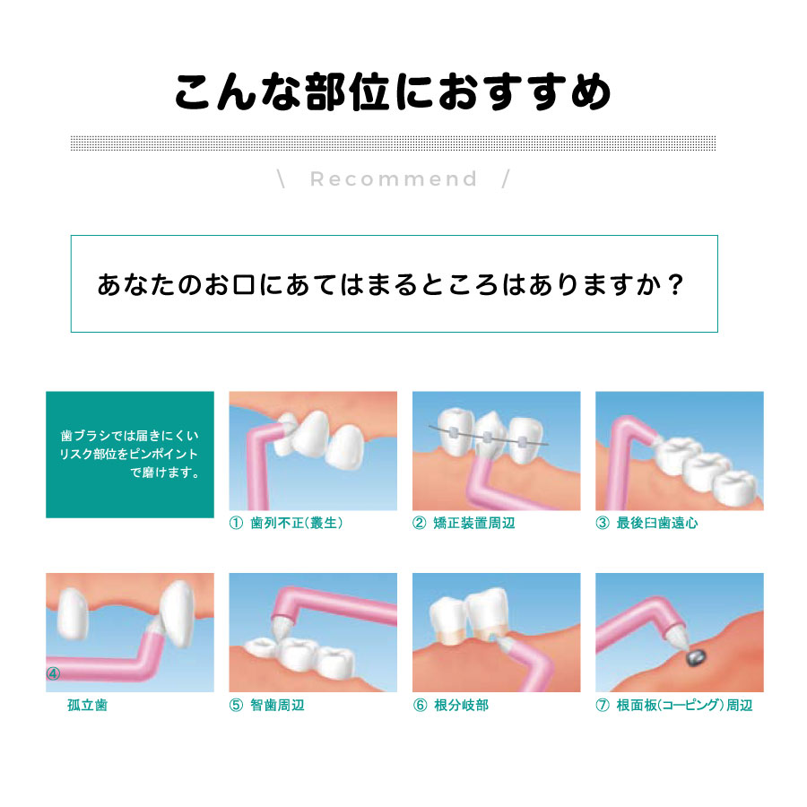 �ڥ᡼����OK��G.V.K��GVK�� ���֥饷 Spot ���ݥåȡڥ���å��դ��ۡ�1�ܡ�