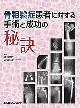 【中古】骨粗鬆症患者に対する手術と成功の秘訣