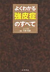 【中古】よくわかる強皮症のすべて