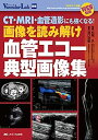 【中古】画像を読み解け 血管エコー典型画像集: CT・MRI・血管造影にも強くなる! WEB動画 (Vascular Lab別冊)(3)