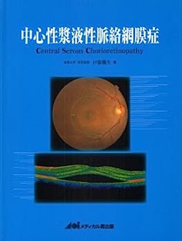 【中古】中心性漿液性脈絡網膜症