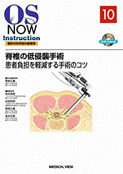  脊椎の低侵襲手術?患者負担を軽減する手術のコツ (OS NOW Instruction)
