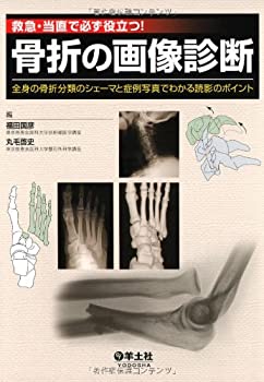 【中古】 救急・当直で必ず役立つ!骨折の画像診断 全身の骨折分類のシェーマと症例写真でわかる読影のポ