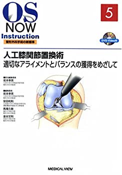  人工膝関節置換術?適切なアライメントとバランスの獲得をめざして (OS NOW Instruction)