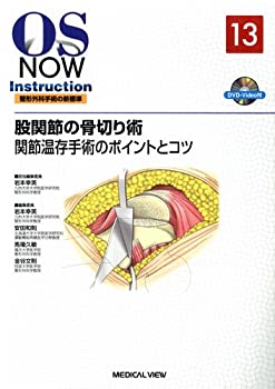  股関節の骨切り術 関節温存手術のポイントとコツ (OS NOW Instruction)