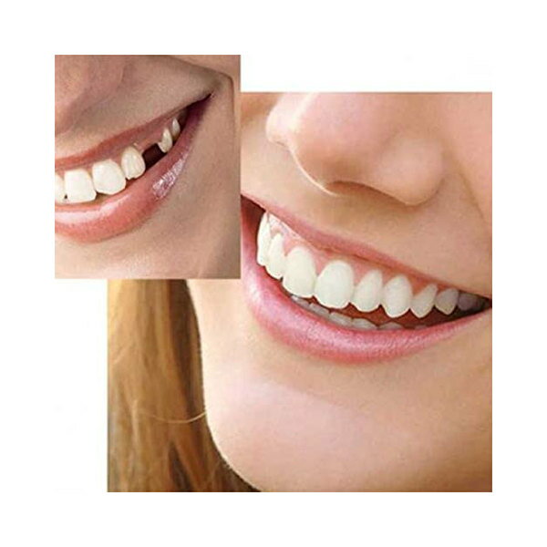 楽天池田ショップ楽天市場店HYGLPXD インスタントベニア義歯、一時的な歯の修復は、壊れた歯と歯のギャップをカバーするために使用されます