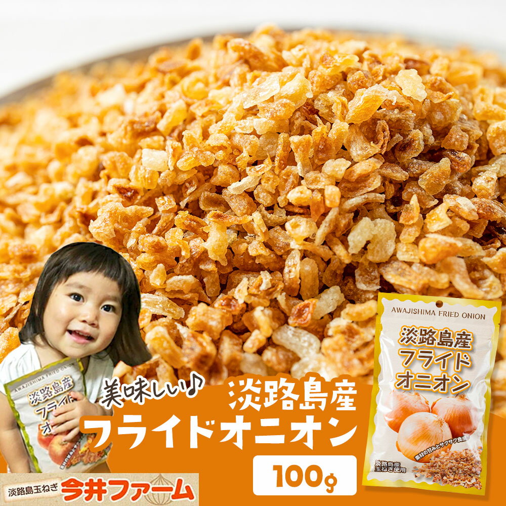 フライドオニオン｜お料理のアクセントに！美味しい玉ねぎチップのおすすめは？