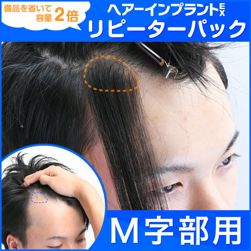 【返品・色交換OK】 2サイズ 人毛100% 部分ウィッグ 頭頂部 ウィッグ 人毛 部分 ヘアピース トップヘアピース 医療用ウィッグ 自然 前髪ウィッグ レディース バレない 普段使い トップカバー トップピース 人毛ウィッグ つむじ ミセス 増毛 薄毛 医療用 かつら つけ毛 女性