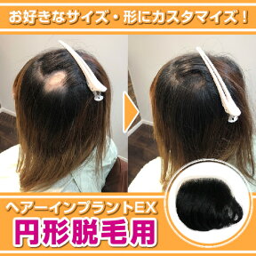 ヘアーインプラントEX円形脱毛症用※装着にはテープかシリコンが必要です